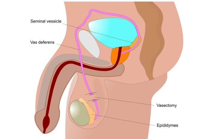 Asthenozoospermia Develop