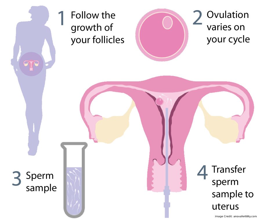 Sperm Flow Info