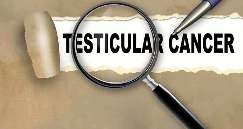 Top 9 Unknown Risk Factors Linked to Testicular Cancer