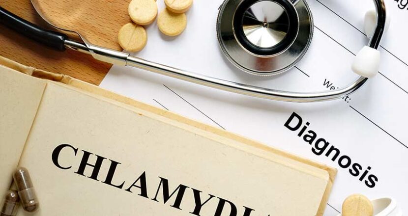 Chlamydia in Men: Causes, Symptoms & Treatment You Must Know