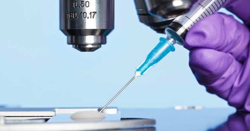 Diagnose Asthenozoospermia