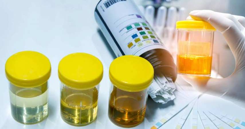 Diagnose Epididymitis