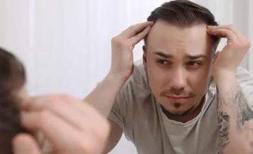 Hair Loss In Men and Poor Testosterone Levels