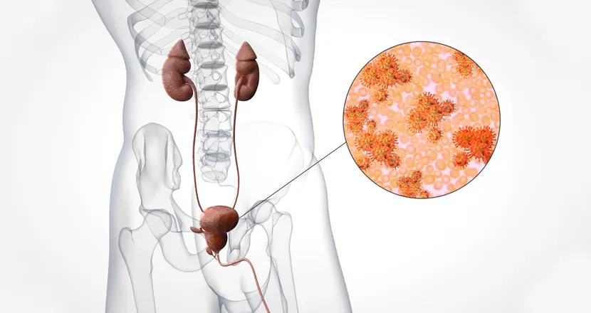 Infection and Prostate Problems: Causes, Symptoms, & Treatment Options