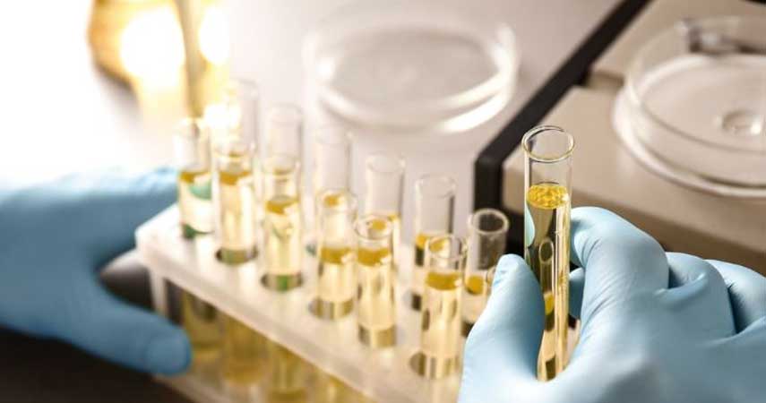 Post-Ejaculate Urine Test