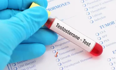 Testosterone Level Test: Low Testosterone Symptoms, Normal Range & Testing