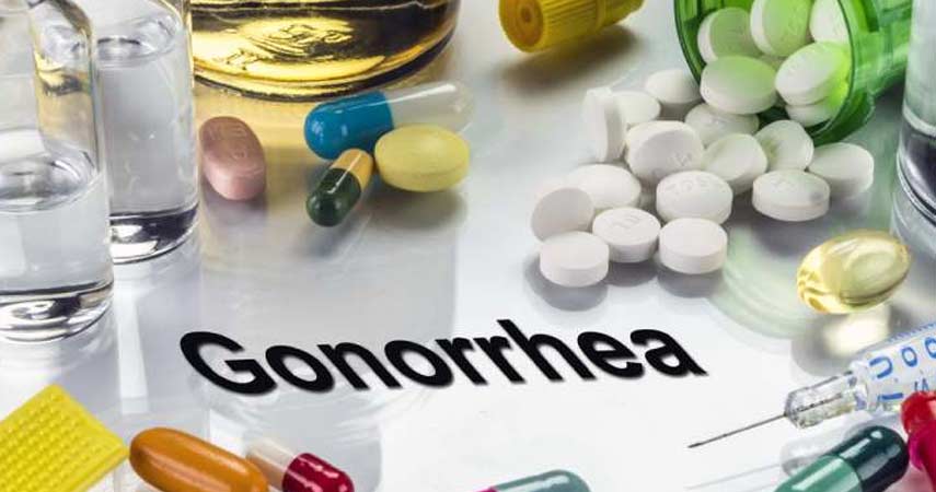Treatment for Gonorrhea