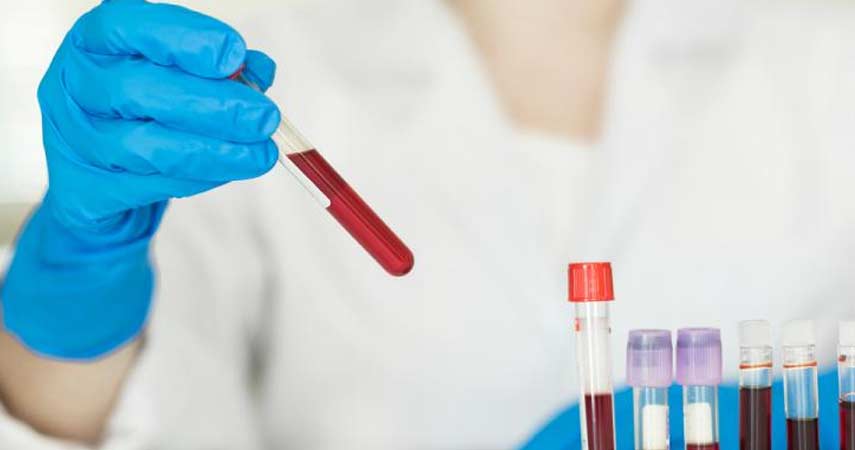 Treatments for Chancroid