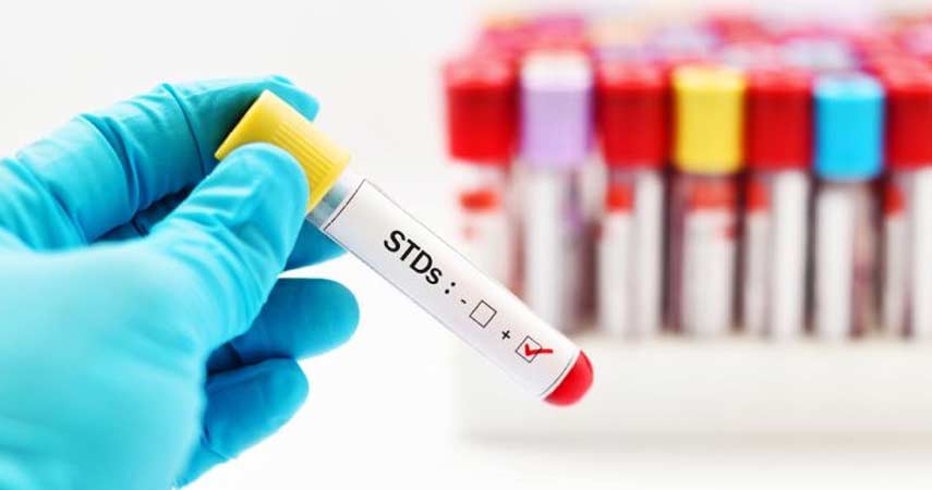 Untreated STDs