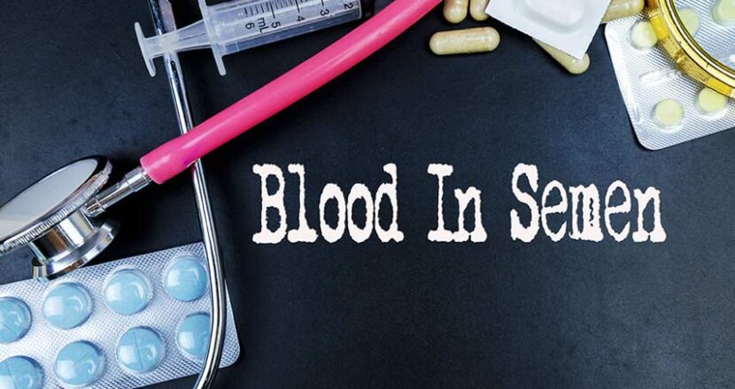 What is Hematospermia? Learn the Causes, Symptoms and Treatment
